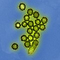 Širenje H1N1 virusa prikazano na elektromikrografku.