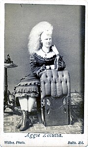 Photographie promotionnelle de femme albinos aux cheveux longs