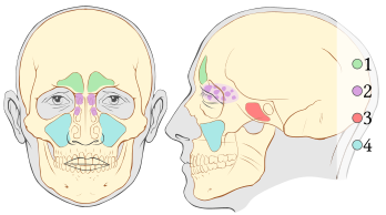 Représentation des sinus paranasaux : en vert (1) les sinus frontaux, en violet (2) les sinus ethmoïdaux, en rouge (3) les sinus sphénoïdaux et en bleu (4) les sinus maxillaires. (image vectorielle)