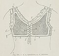 Corselet-gorge de Mme Cadolle.