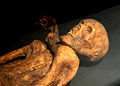 Mummy of Ötzi the Iceman.