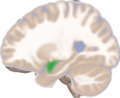 Left lateral view of the amygdala in an average human brain