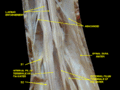 Spinal cord. Spinal membranes and nerve roots. Deep dissection. Posterior view.