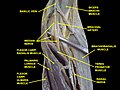 Deep dissection; anterior view