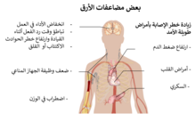 مضاعفات الأرق