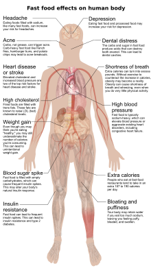 An diagram showing how fast food can affect the human body, including headaches, depression, acne, dental distress, heart disease or stroke, shortness of breath, high cholesterol, high blood pressure, weight gain, blood sugar spike, extra calories, insulin resistance, and bloating and puffiness.