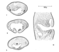 Section of genital atrium