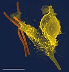 Neutrophil (yellow/right) engulfing anthrax bacteria (orange/left)