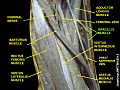 Gracilis muscle