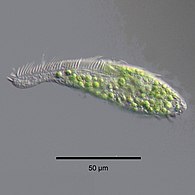 Zoochlorellae (green) living inside the ciliate Stichotricha secunda