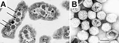 Description de l'image Carboxysomes EM.jpg.