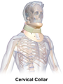 Collar cervical.