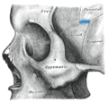 Left zygomatic bone in situ. (Sphenoparietal suture visible at upper right in blue.)