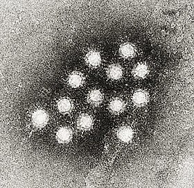 Partículas virais de Hepatovirus