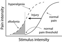 AMPS, pain amplification syndrome, juvenile fibromyalgia, childhood fibromyalgia