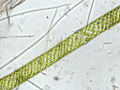 Spirogyra sp.