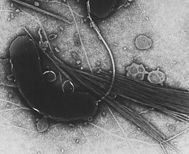Transmission electron microscope image of Vibrio cholerae that has been negatively stained.