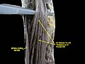 Spinal cord. Spinal membranes and nerve roots. Deep dissection. Posterior view.