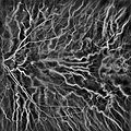 Laser Doppler imaging of retinal and choroidal blood flow