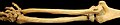 Bones of the right arm, showing the ulna, radius, wrist and humerus