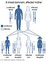 X-linked dominant inheritance, affected mother