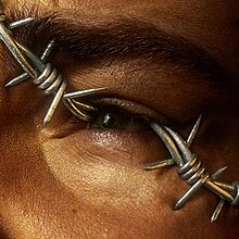 A stuck barbed wire on someone's eye