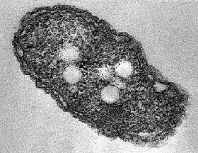 Azotobacter vinelandii