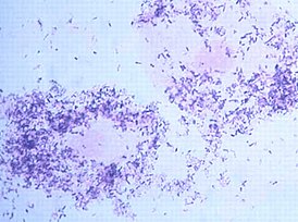 Морфотипы Gardnerella vaginalis во влагалищном мазке, под микроскопом.