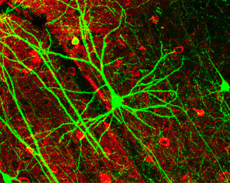 microscopic image of a neuron