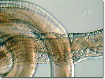 Mannetjes zweepworm (Trichuris trichiura) met bacillaire band