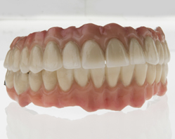 Totale Gebissrekonstruktion auf Zahnimplantaten, von vestibulär