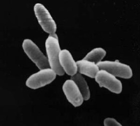 Μικρογραφία συστάδας κυττάρων είδους αλοβακτηρίου (Halobacterium sp.) στέλεχος NRC-1, όπου κάθε κύτταρο έχει μήκος περίπου 5 μm.