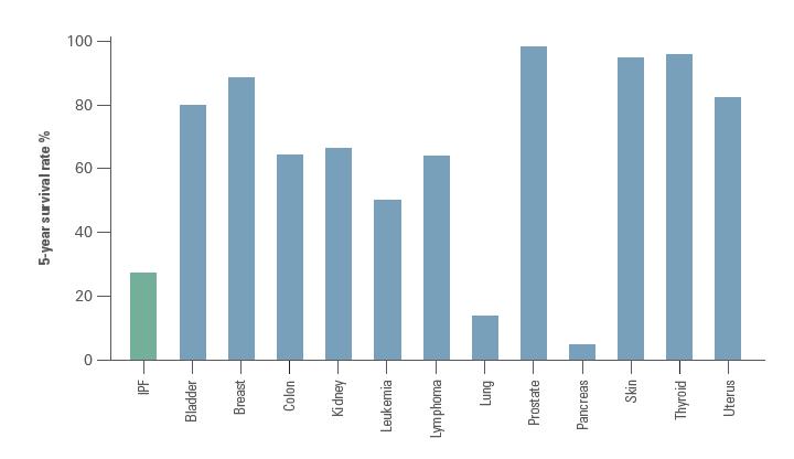 Vergleich der 5-Jahres-Überlebensrate zwischen IPF und gängigen Malignomen. Adaptiert nach Bjoraker et al. 1998.[38]