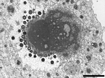 „Sputnik 3“-Virophagen, produziert in einer VF von Courdo11 (Spezies Megavirus chilensis, Gruppe C-Mimiviren). Balken 2 µm.[5]