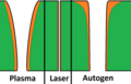 Querschnitte der Schnittfugen beim Plasma-Schmelzschneiden, Laserschneiden und Autogenen Brennschneiden