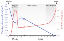 Graph of HIV levels (red) and decline in T cells (blue) during progression of HIV/AIDS