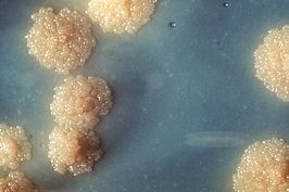 kolonies van de Mycobacterium tuberculosis op een kweekplaat