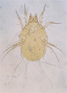 Glycyphagus grain mite, cause of allergy