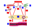 This model is a representation of the process of Diabetic Ketoacidosis. A: Muscle Fiber B: Amino Acids C: Liver E: Fatty Acids F: Glucagon G: Blood Vessel 1. Lack of insulin leads to the release of amino acids from the muscle fiber. 2. Amino acids are released from the muscle fiber, which get converted into glucose inside of the liver. 3. The Glucose produced becomes abundant in the bloodstream. 4. Fatty Acids and Glycerol are released from the adipose tissue, which get converted into ketones inside of the liver. 5. Along with the Fatty Acids and Glycerol, the Glucose produced from the lack of insulin also gets converted into ketones inside of the liver. 6. The ketones produced become abundant in the bloodstream. This leads to high blood sugar levels, nausea, vomiting, thirst, excessive urine production, and abdominal pain. Partially derived from: http://en.wiki.x.io/wiki/Glucagon