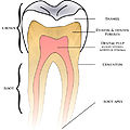 Pros: nice texture on dentin; nice colors. Cons: End of roots fades into white for some reason