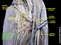 Anterior and posterior interosseous artery