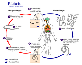 Filariasis