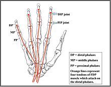 A drawing of the hand and tendons.