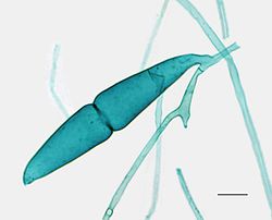 Plasmogamie bij de vorming van een Rhizopus-zygospore van een broodschimmel