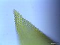 top of the leaf, magnified 400 times, note that the upmost 3 endcells are truncated, Photo by Kristian Peters