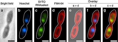 A. laminatus RT761T. Konfokalmikroskopie zeigt die Orte von DNA und RNA innerhalb der intrazytoplasmatischen Membran. DNA, RNA und Membran­lipide wur­den ver­schie­denen Me­thoden ge­färbt, a ist Phasen­kontrast-, b-d Konfokal-Bilder, e-g Bild­über­lagerungen. Balken 1­μm.