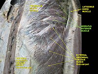 Nhìn từ phía trước * Serratus anterior muscle: Cơ răng trước * Anterior thoracic wall: Thành ngực trước * External abdominal oblique muscle: Cơ chéo bụng ngoài.