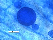 Bilayered glomoid spore of arbuscular mycorrhizal fungi in the root of Horse Gram