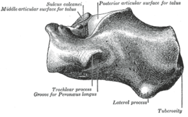 {linker calcaneus, lateraal