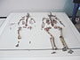 Funde aus dem Oberkasseler Grab: Die beiden Skelette, links die sterblichen Überreste der Frau, rechts die des Mannes. An der linken Seite zwei Kulturbeigaben, darunter der Teil eines Hundegebisses